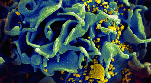 An-HIV-infected-T-cell.jpg