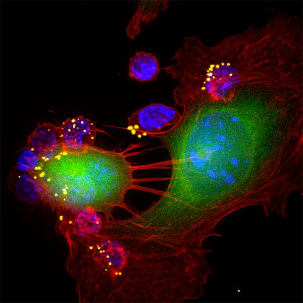 An award-winning image of CTLs attacking a tumor cell (Photo:Sudha Kumari)