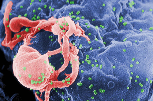 Scanning electron micrograph of HIV virions Image: Public Health Image Library